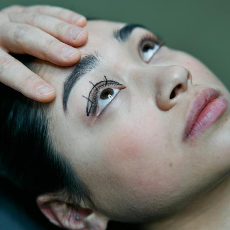 eyelid-treatment-544baef7ab0b4a15a6beb2f7b2a68fb0