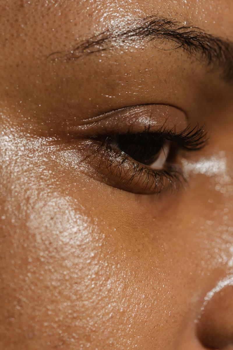 facial fillers