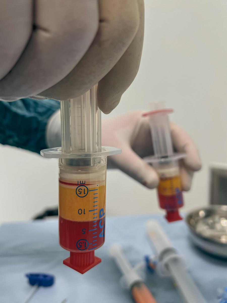 medical plasma