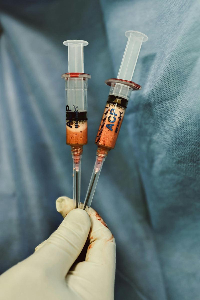 platelet-rich plasma