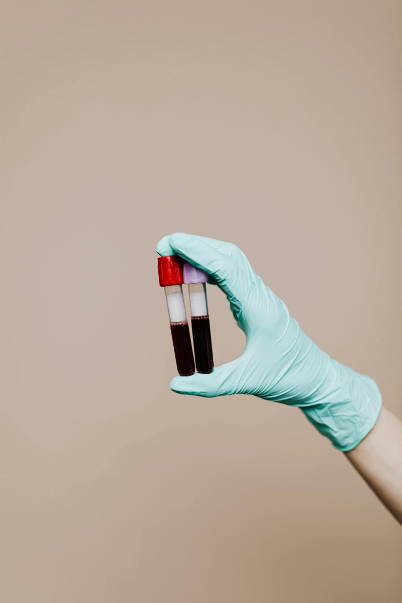 platelet-rich plasma